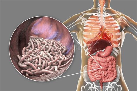  Tegumentarius! Un Ver Parasite Qui Se Cache Dans Les Vents de L’Intestin