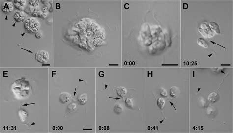  Zoosporangium! Une exploration fascinante de ce petit maître du changement de forme